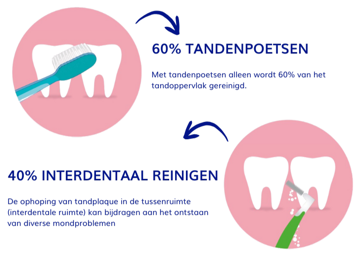 Interdentaal reinigen